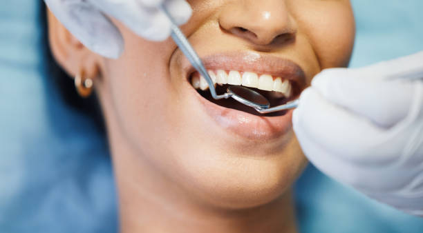 Best Emergency Tooth Extraction in Battlefield, MO